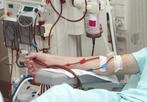 هورمون درمانی برای همه بیماران سرطان پروستات ضروری نیست