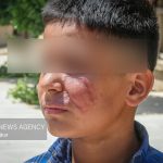 ۱.۵ میلیارد تومان برای آموزش و مقابله با سالک در دامغان تخصیص یافت
