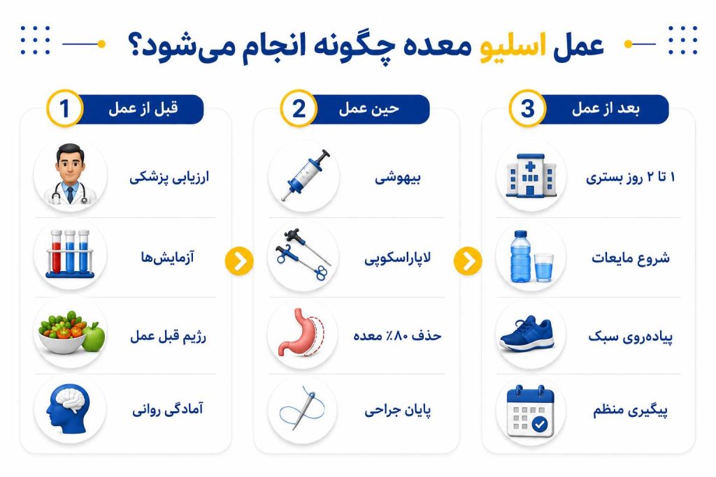 اسلیو معده چیه