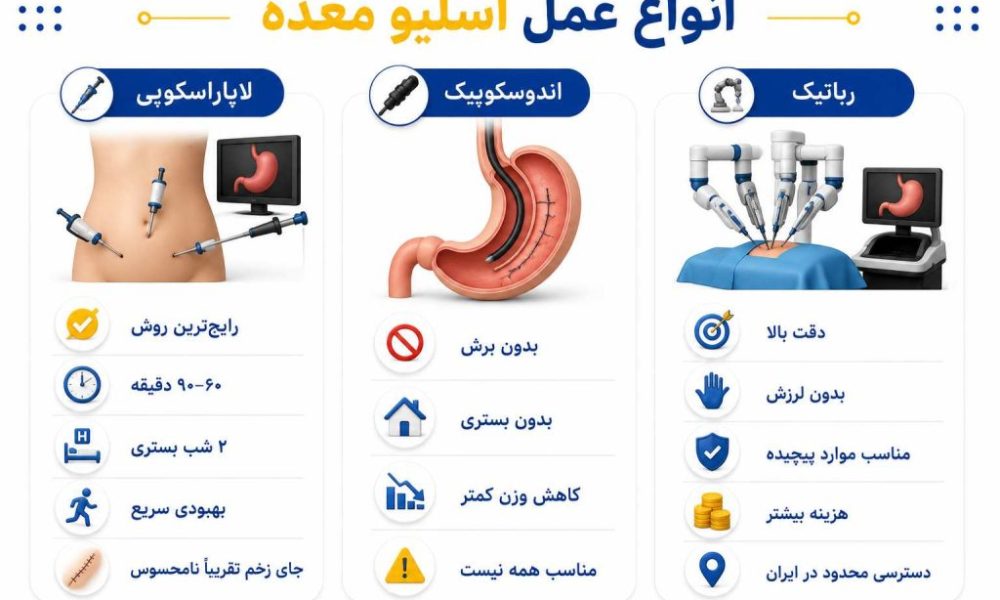 عمل اسلیو چیست