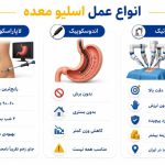 عمل اسلیو چیست